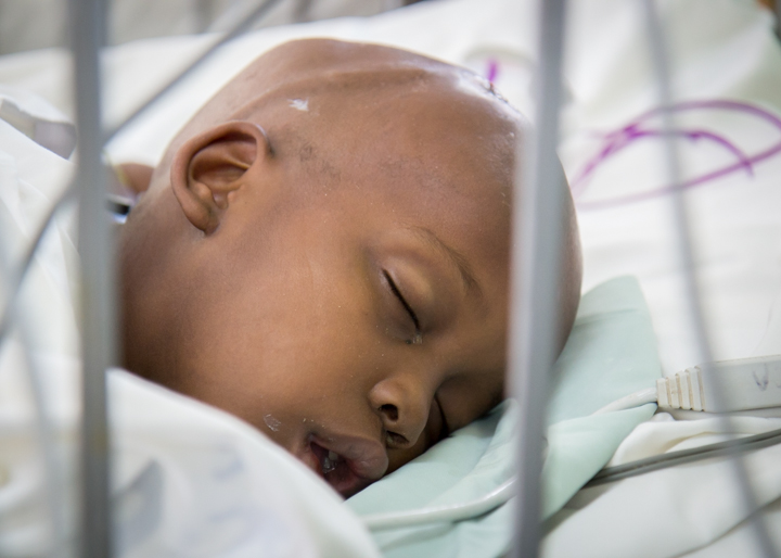 Ugandan Hospital Pioners New Treatment for Hydrocephalus | Pulitzer Center