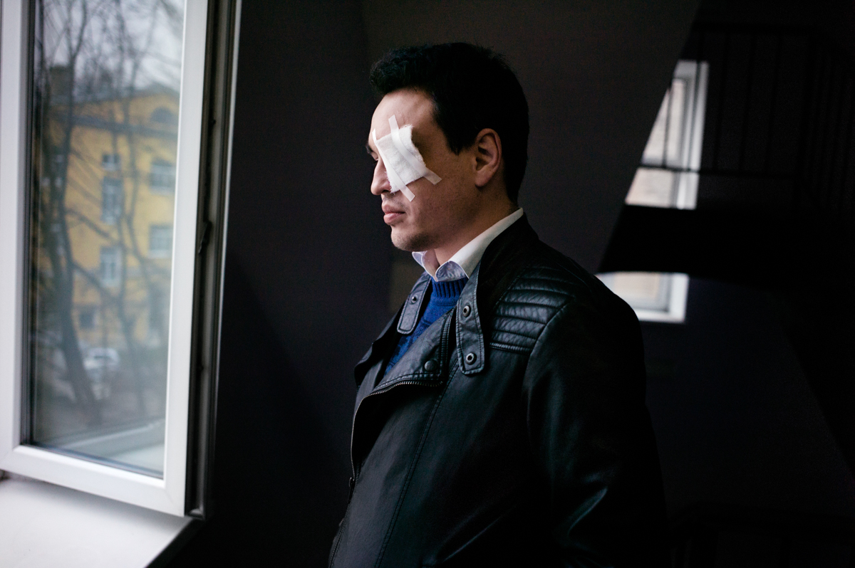Dmitry Chizhevsky in a Saint Petersburg hospital, where he was treated for a month and a half, following an attack on an LGBT meeting. Doctors were not able to save his vision in his left eye. Image by Misha Friedman. Russia, 2013. Media file: chizhevsky-2.jpg