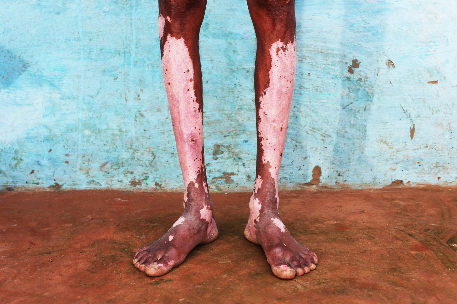 Leather Comes At a Price to India's Workers Pulitzer Center