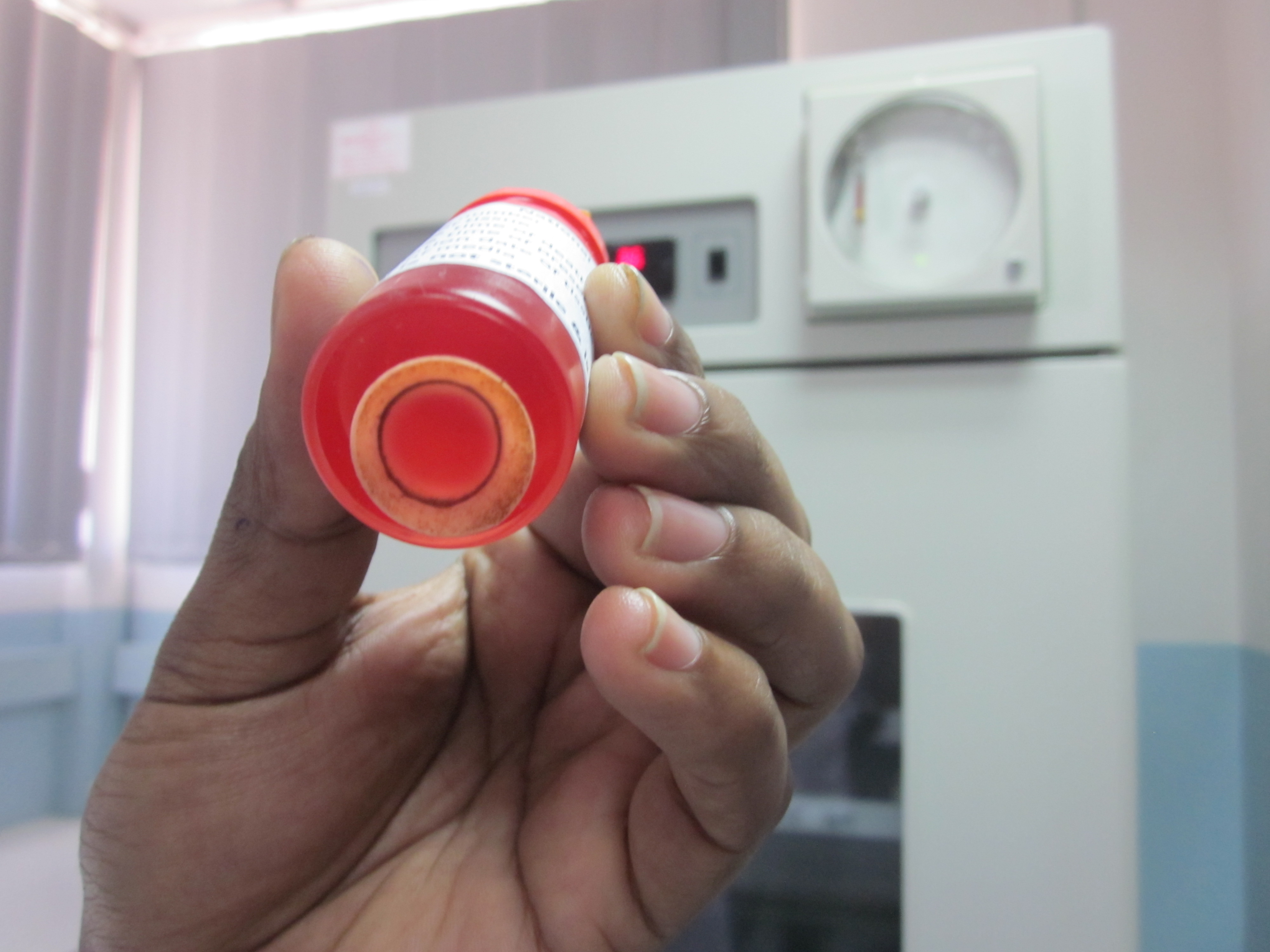 A cornea in storage at Sri Lanka's National Eye Bank in Colombo. Image by Ross Velton. Sri Lanka, 2015. Corneas must be used within about four weeks.