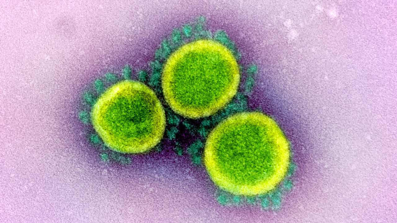 Johnson & Johnson is launching a major push to develop a vaccine that can neutralize the new coronavirus. Image by National Institute of Allergy and Infectious Diseases / National Institutes of Health. United States, 2020. Johnson & Johnson is launching a major push to develop a vaccine that can neutralize the new coronavirus. Image by National Institute of Allergy and Infectious Diseases / National Institutes of Health. United States, 2020.