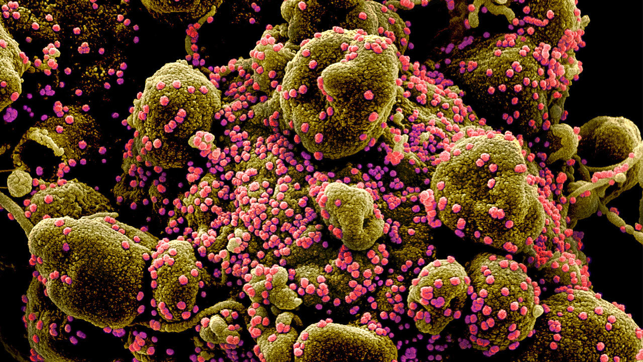 Many new vaccines are being tested to thwart the pandemic coronavirus, which infects a human cell (brown) with deadly efficiency to produce new copies (pink). National Institute of Allergy and Infectious Diseases / National Institutes of Health. Many new vaccines are being tested to thwart the pandemic coronavirus, which infects a human cell (brown) with deadly efficiency to produce new copies (pink). National Institute of Allergy and Infectious Diseases / National Institutes of Health.