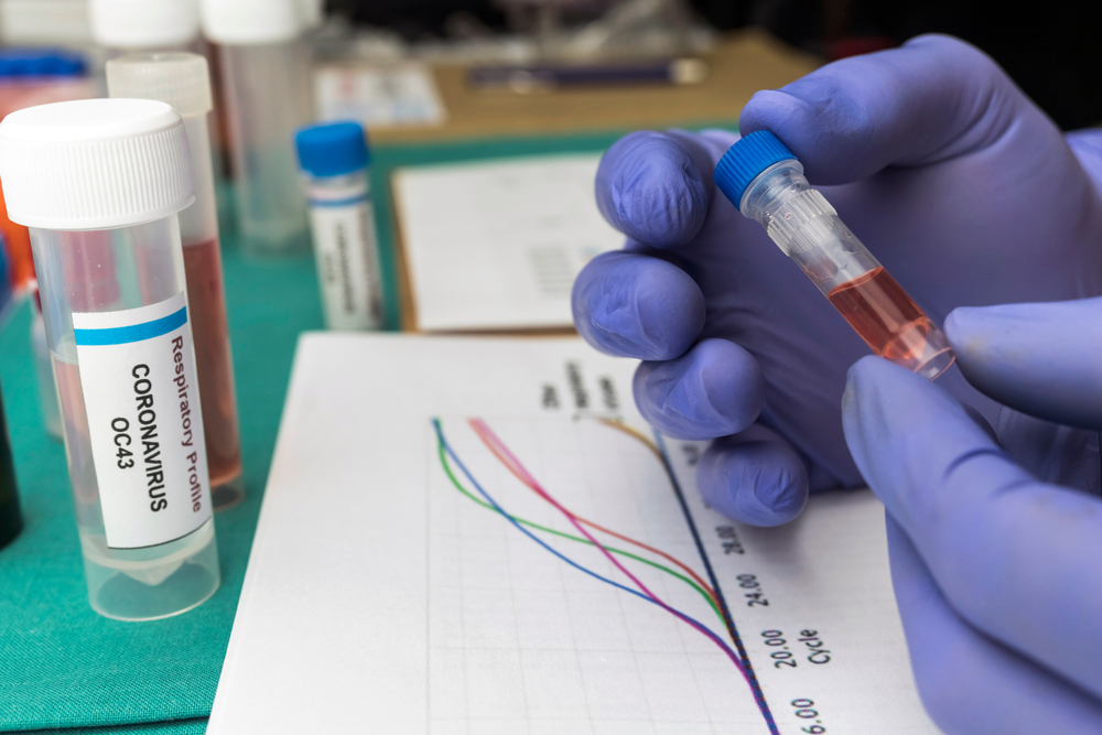A scientist studies the curves of the Covic-19 pandemic and the DNA of an infected person, holding a sample vial in a hospital. Image by Felipe Caparros / Shutterstock. Spain, 2020. A scientist studies the curves of the Covic-19 pandemic and the DNA of an infected person, holding a sample vial in a hospital. Image by Felipe Caparros / Shutterstock. Spain, 2020.