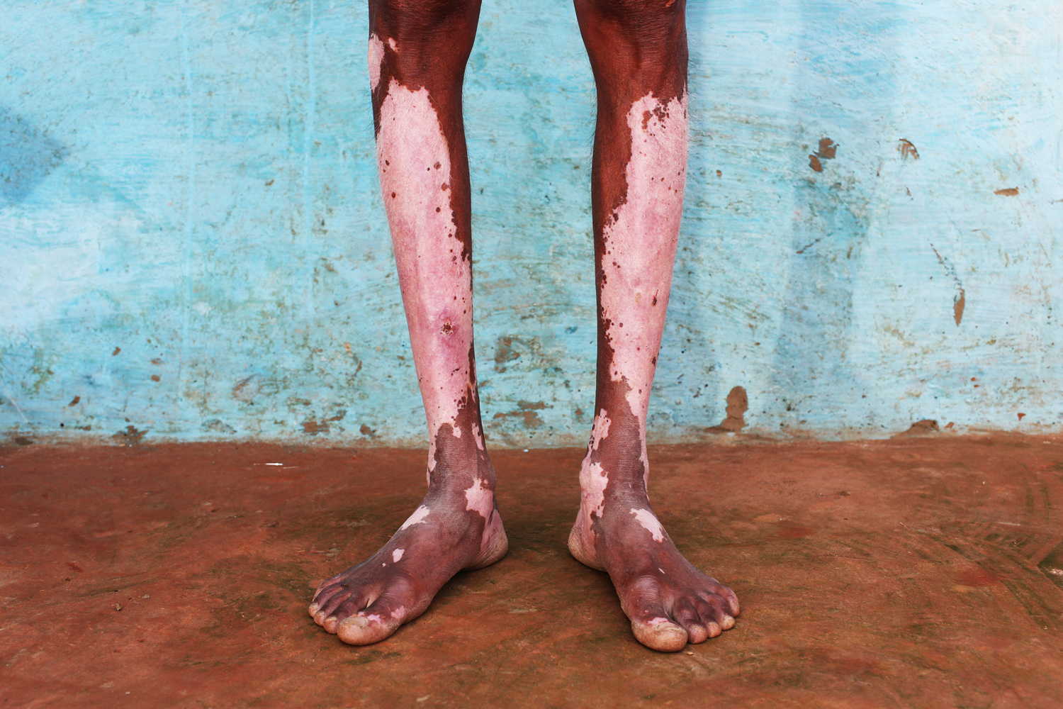 The Toxic Price Of Leather In India Pulitzer Center