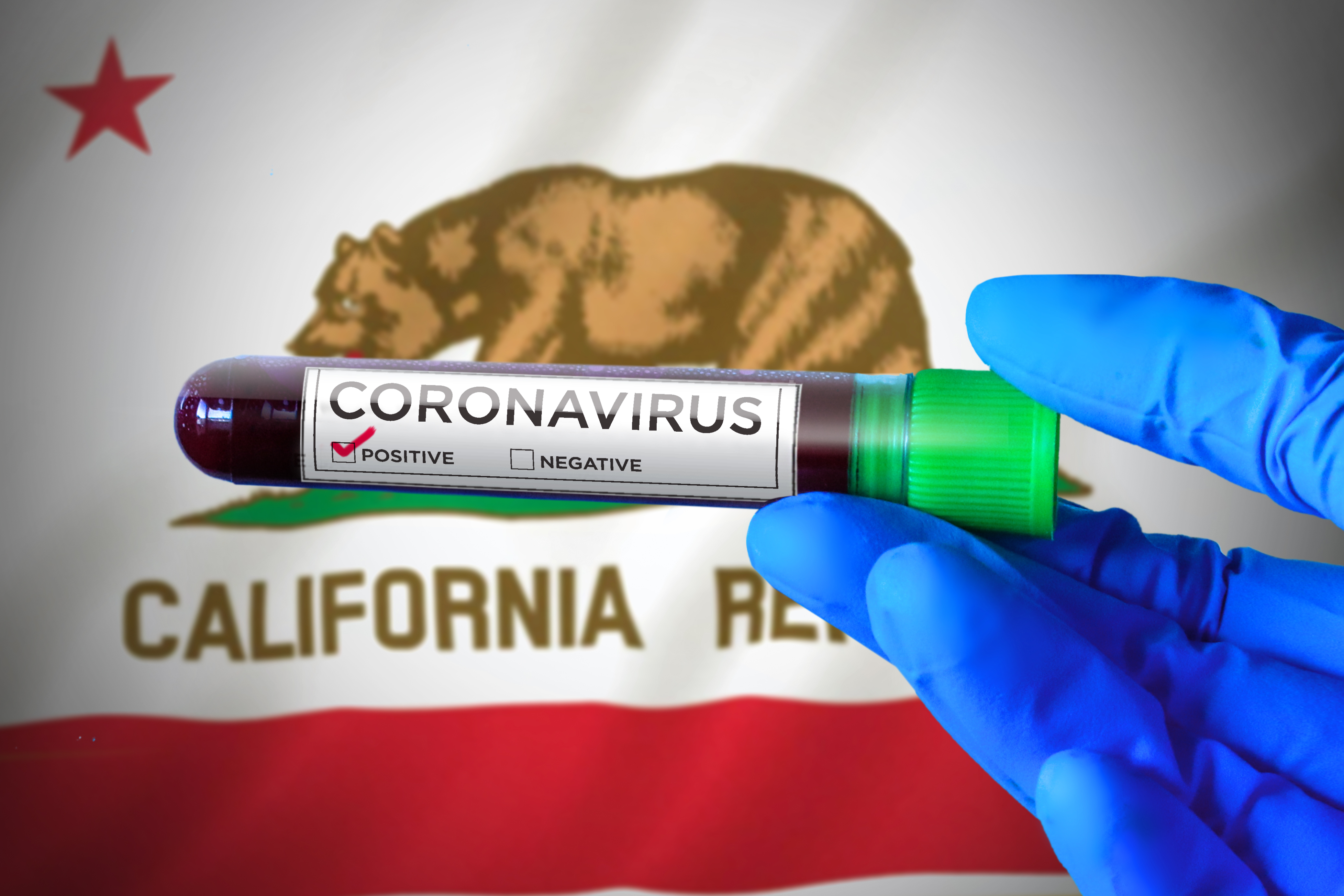 California has closed 11 public health labs over the past two decades, impeding the implementation of "targeted testing." Image by Kim Kuperkova / Creative Commons. United States, 2020. California has closed 11 public health labs over the past two decades, impeding the implementation of "targeted testing." Image by Kim Kuperkova / Creative Commons. United States, 2020.