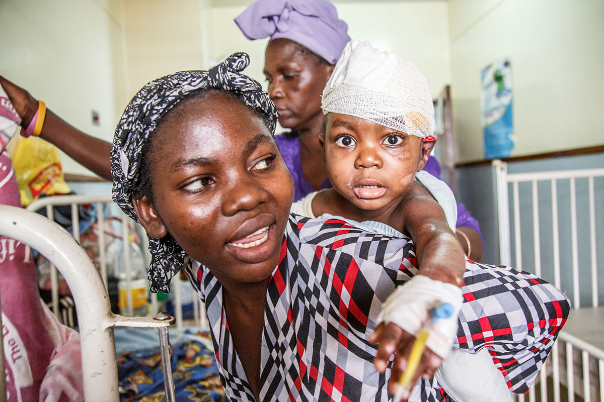 Jacqueline, 2, just comes from the operating room. She suffered severe burns and underwent second surgery at Kamuzu Central Hospital in the capital of Malawi Lilongwe. Her mother Eliza has good hope that she will be healthy again soon. Image by Nathalie Bertrams. Malawi, 2017. Jacqueline, 2., just comes from the operating room. She suffered severe burns and underwent second surgery at Kamuzu Central Hospital in the capital of Malawi Lilongwe. Her mother Eliza has good hope that she will be healthy again soon. Image by Nathalie Bertrams. Malawi, 2017.