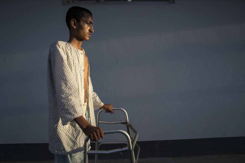 Ahah Kahn, 19, is barely able to walk after a serious brain injury caused by an IED. Atah was a sheep herder from Helmand who had been at the hospital for a month recovering his strength. Image by Paula Bronstein. Lashkar Gah, Afghanistan, 2015. Lashkar Gah, Afghanistan