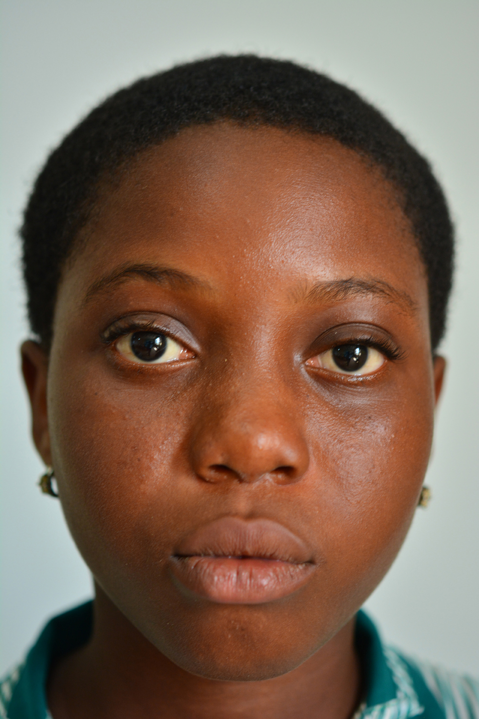  Skin Bleaching  in Ghana The Next Generation Pulitzer 