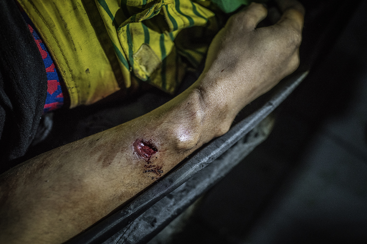 The indentation on the wrist of Julius Soriano, 24-years-old, shows signs that his hands were bound before he was shot to death during a police operation in Caloocan, Metro Manila. There is a bullet wound in his arm too, and the slug is still embedded in his arm, coming to a stop exactly were the indentation line left an impression in his skin, suggesting that whatever caused the indentation stopped the bullet too. Image by James Whitlow Delano. Philippines, 2017. The indentation on the wrist of Julius Soriano, 24-years-old, shows signs that his hands were bound before he was shot to death during a police operation in Caloocan, Metro Manila. There is a bullet wound in his arm too, and the slug is still embedded in his arm, coming to a stop exactly were the indentation line left an impression in his skin, suggesting that whatever caused the indentation stopped the bullet too. Image by James Whitlow Delano. Philippines, 2017.