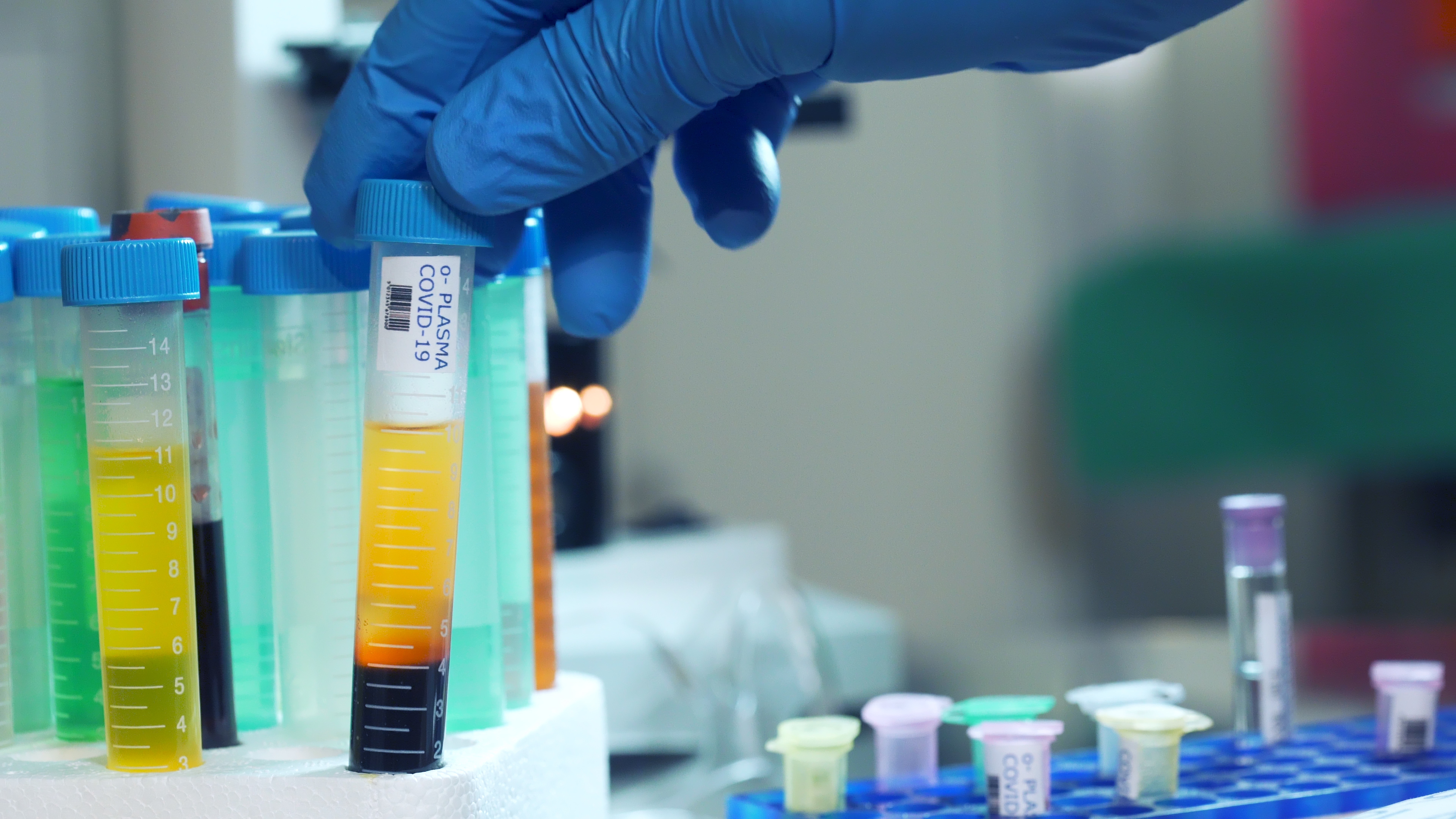 A large plastic vial containing blood plasma from a patient who has survived COVID-19. Image by JHDT Productions / Shutterstock. 2020. A large plastic vial containing blood plasma from a patient who has survived COVID-19. Image by JHDT Productions / Shutterstock. 2020.