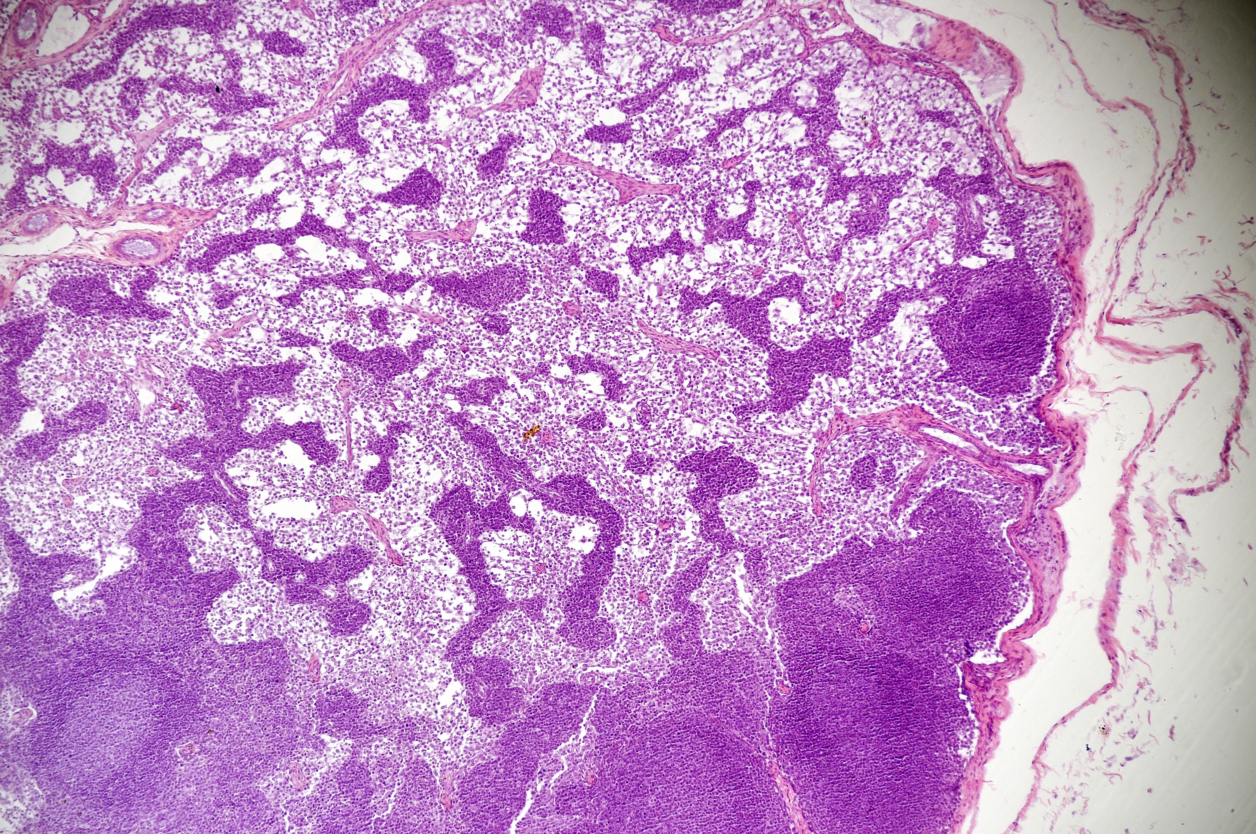 Microscopic view of a lymph node Microscopic view of a lymph node