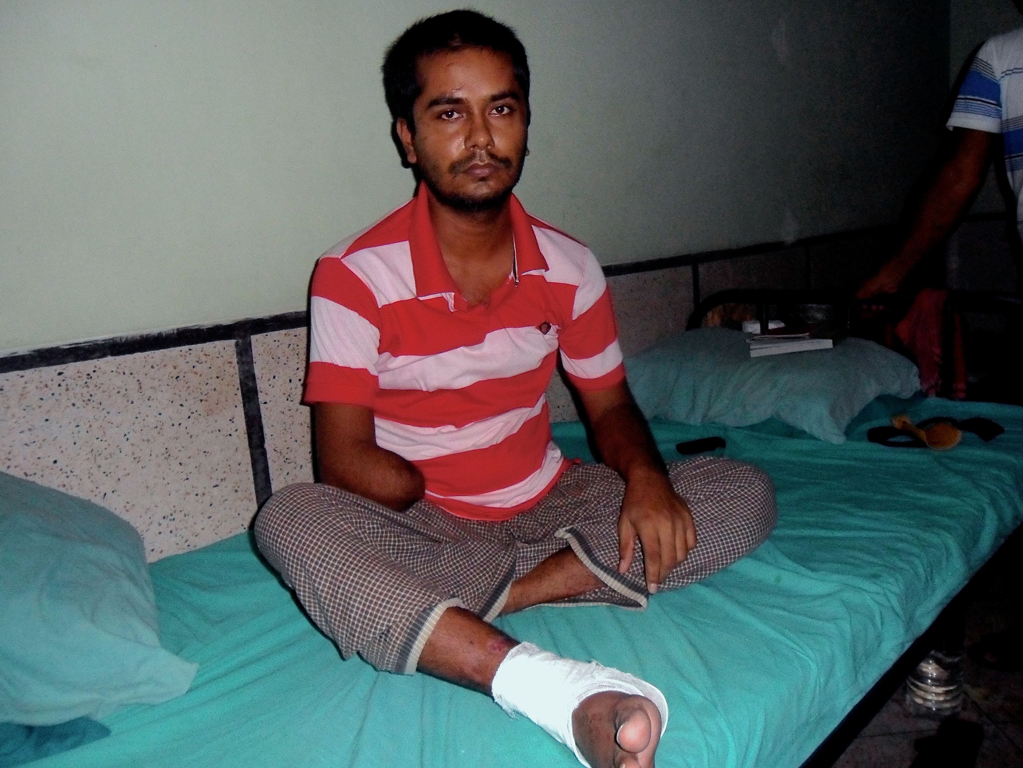 Rana Plaza survivor Saddam Hossain recovers in a hospital after the building collapse claimed part of his right arm. Image by Golam Mortuja. Bangladesh, 2016. Rana Plaza survivor Saddam Hossain recovers in a hospital after the building collapse claimed part of his right arm. Image by Golam Mortuja. Bangladesh, 2016.