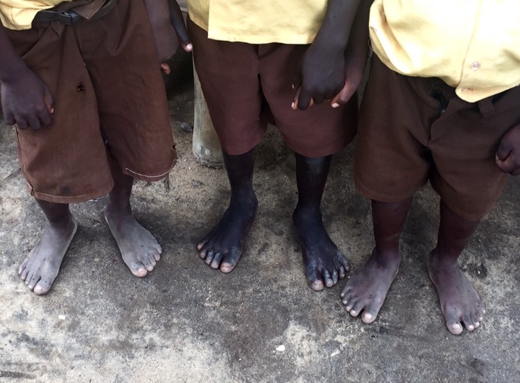 A Day Without Shoes | ST JOHN'S D.S.G. - PIETERMARITZBURG