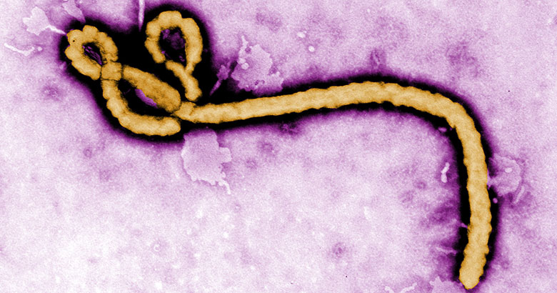Colorized transmission electron micrograph (TEM) revealing some of the ultrastructural morphology displayed by an Ebola virus virion. Image by Frederick Murphy, Courtesy of CDC.