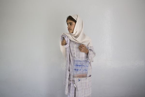 Madina, 12, lost her arm, when a rocket hit her home in Paktia, Kabul on April 6, 2016. She is recovering from an operation from complications with her pancreas at the Emergency hospital. Image by Paula Bronstein. Afghanistan, 2016. Madina, 12, lost her arm, when a rocket hit her home in Paktia, Kabul on April 6, 2016. She is recovering from an operation from complications with her pancreas at the Emergency hospital. Image by Paula Bronstein. Afghanistan, 2016.