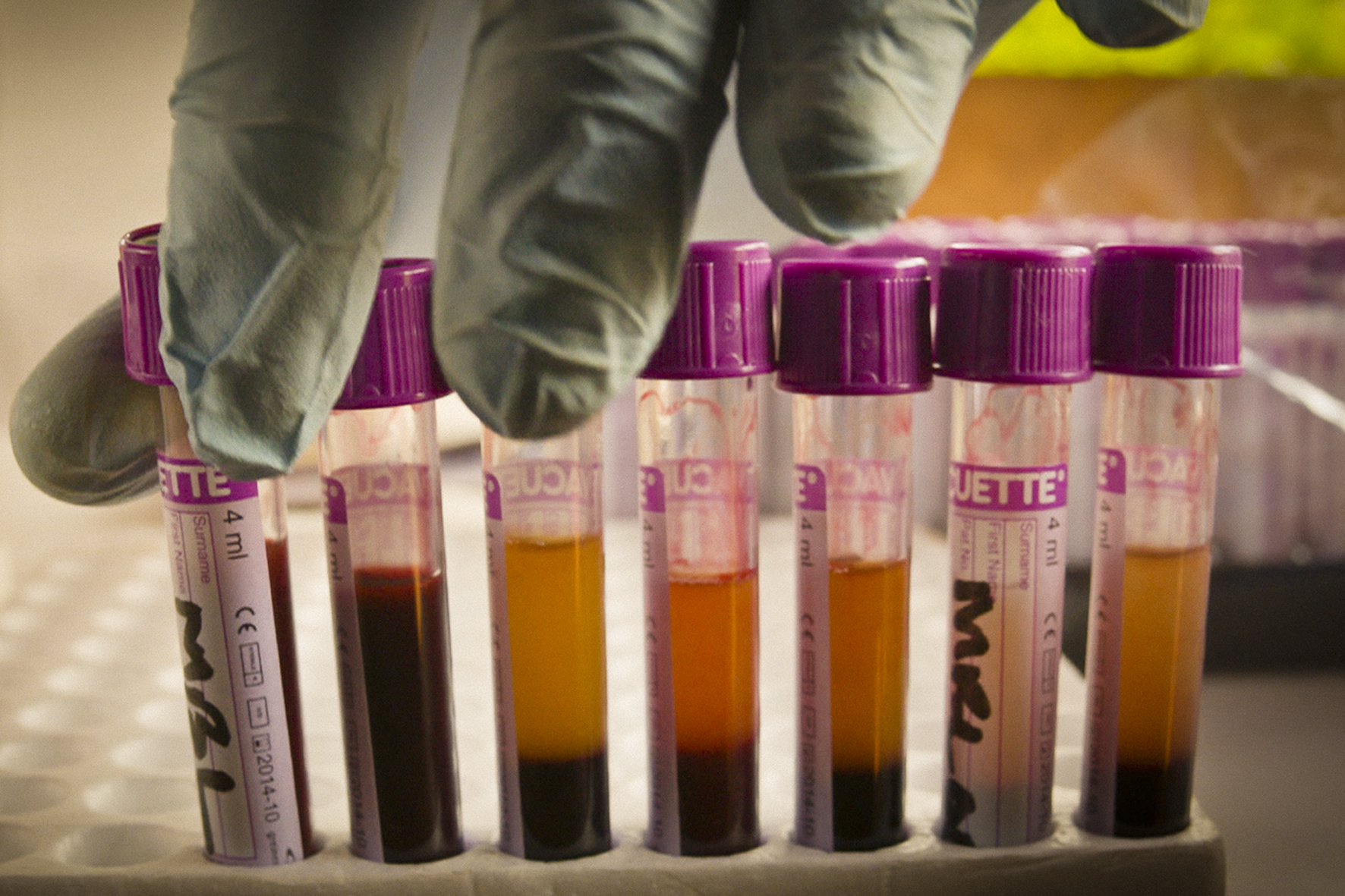 Blood tests reveal that new viruses regularly jump from wild animals to humans. Image by Renaat Lambeets, DOCDAYS Productions. DRC, 2103. Media file: tbt_11.jpg