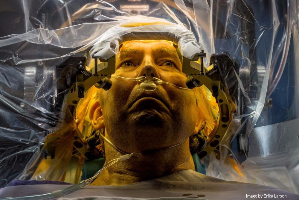 At the University of Florida, Parkinson’s disease patient Russell Price undergoes surgery to implant a deep brain stimulation (DBS) lead that will deliver electrical impulses to motion-controlling parts of his brain, treatment which has been shown to provide substantial relief from symptoms in appropriately selected patients. Additional improvement in some patients may also derive from the mere expectation that the procedure will help—the so-called placebo effect. “It’s not a magical thing,” says neurologist Michael Okun. “It’s another part of the brain that is producing a beneficial effect not directly related to the action of our treatment.” Image by Erika Larson. Florida, 2016. At the University of Florida, Parkinson’s disease patient Russell Price undergoes surgery to implant a deep brain stimulation (DBS) lead that will deliver electrical impulses to motion-controlling parts of his brain, treatment which has been shown to provide substantial relief from symptoms in appropriately selected patients. Additional improvement in some patients may also derive from the mere expectation that the procedure will help—the so-called placebo effect. “It’s not a magical thing,” says neurologis