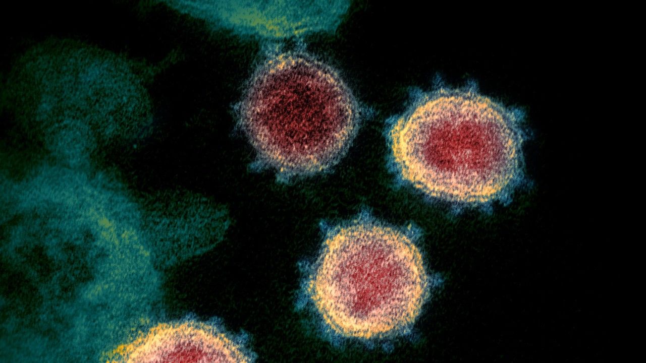 The pandemic coronavirus SARS-CoV-2 (shown above) may under certain conditions integrate its genetic material into human cells, confounding COVID-19 diagnostic tests. Image by NIAID. The pandemic coronavirus SARS-CoV-2 (shown above) may under certain conditions integrate its genetic material into human cells, confounding COVID-19 diagnostic tests. Image by NIAID.