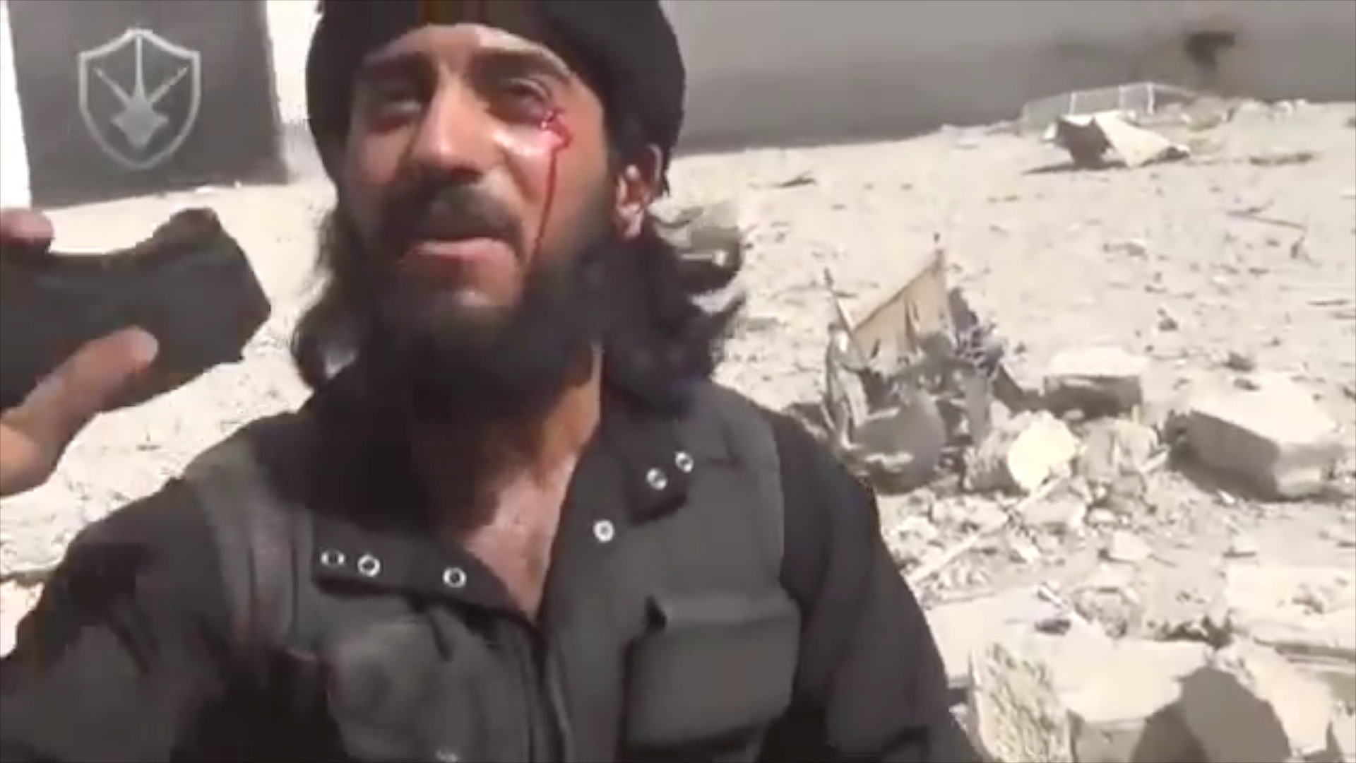 Wounded rebel fighter as seen in a rebel video. Image sourced by Reese Erlich. Syria, 2013. Media file: syrian_rebel_wounded.jpg