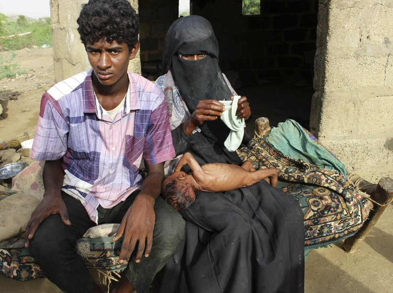 Severely malnourished infant Zahra is changed by her mother, right, in the village of al-Mashradah, Aslam, Hajjah. Image by Hammadi Issa for AP. Yemen, 2018. Severely malnourished infant Zahra is changed by her mother, right, in the village of al-Mashradah, Aslam, Hajjah. Image by Hammadi Issa for AP. Yemen, 2018.