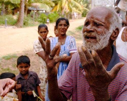 This elderly man was forced from his home two years ago and is desperate to return, Eastern Province. 1