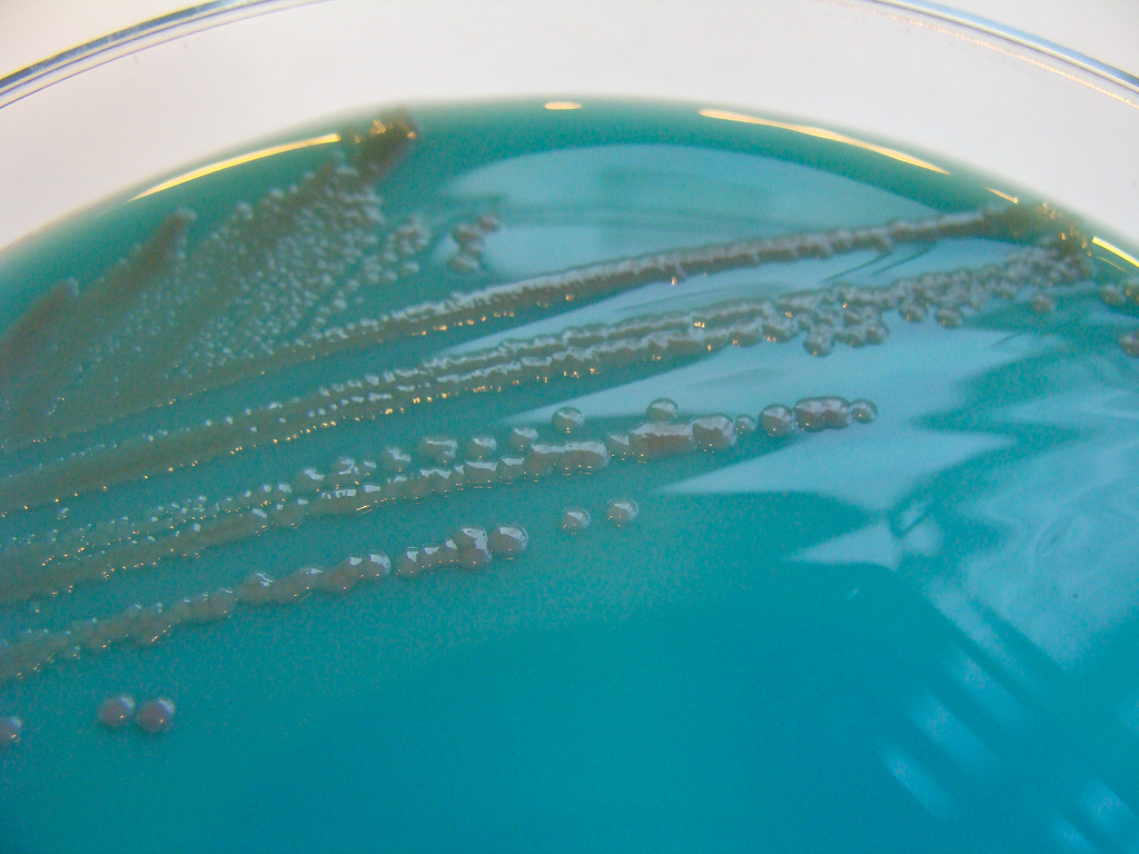 Antibiotic-resistant NDM-1. Image by Nathan Reading / Flickr.