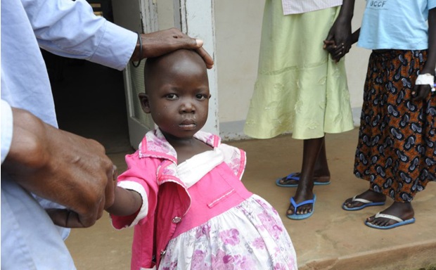 Veronica Alebo, a young Burkitt's lymphoma patient, has a large tumor in her abdomen. She receives treatment at the Uganda Cancer Institute in Kampala. Image by Jacqueline Koch. Uganda, 2012.
