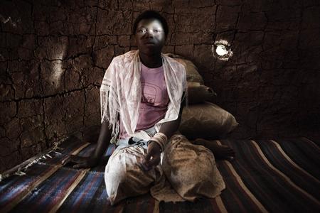 Josephine Gambolipai, 13 years old, was abducted in July 2009 and escaped in December 2009 as a result of an attack by the military of the Democratic Republic of Congo (FARDC). She was saved as a wife for Joseph Kony and therefore only had to carry light clothes and was not forced to work. (Photo by Marcus Bleasdale) Josephine Gambolipai, 13 years old, was abducted in July 2009 and escaped in December 2009 as a result of an attack by the military of the Democratic Republic of Congo (FARDC). She was saved as a wife for Joseph Kony and therefore only had to carry light clothes and was not forced to work. (Photo by Marcus Bleasdale)