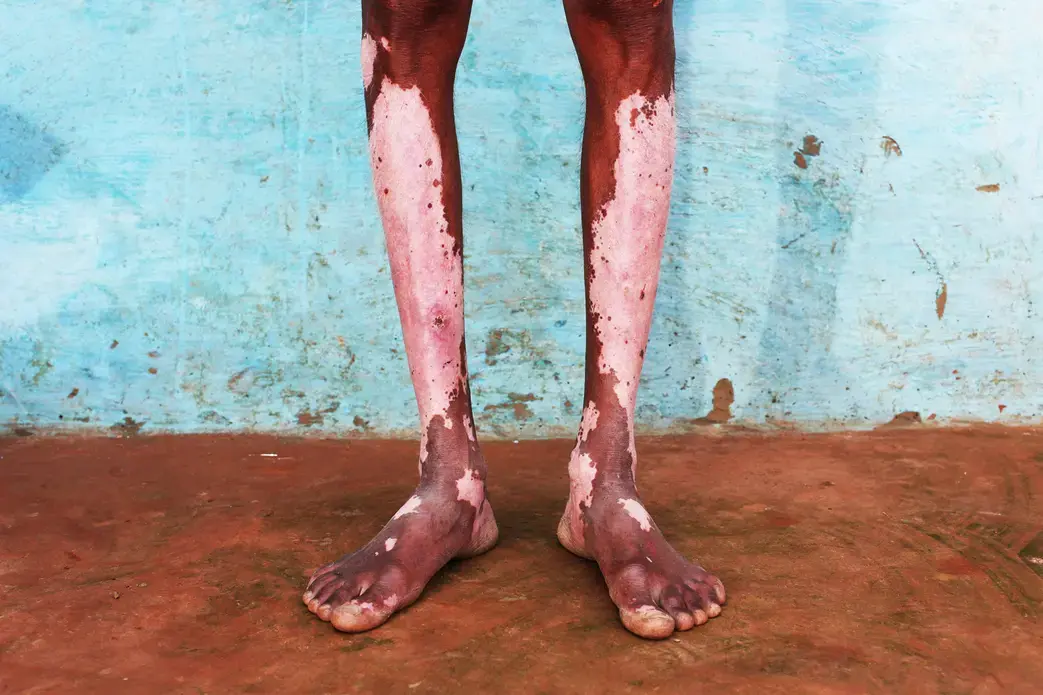 India The Toxic Price of Leather Pulitzer Center