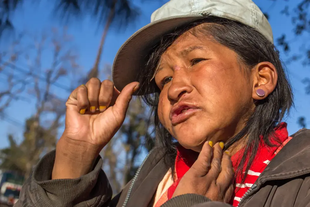Esmeralda Cespedes, 25, said she doesn't inhale glue. But she drinks alcohol “because of the problems I have in my life. A lot of people bother me.” Image by Tracey Eaton. Bolivia, 2017. Esmeralda Cespedes, 25, said she doesn't inhale glue. But she drinks alcohol “because of the problems I have in my life. A lot of people bother me.” Image by Tracey Eaton. Bolivia, 2017.