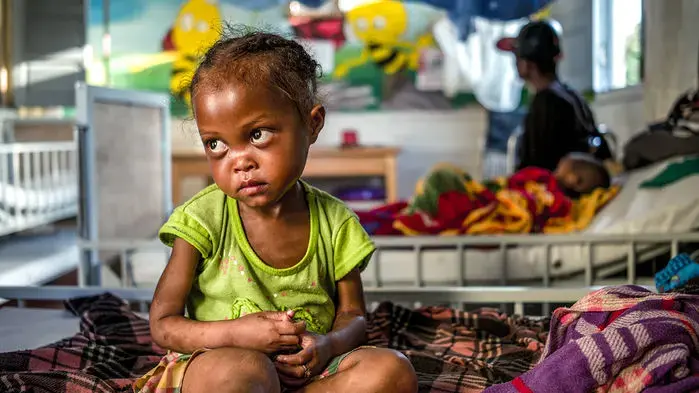After being treated for severe malnutrition at Ifanadiana District Hospital, this girl is about to go home. Image by Rijasolo. Madagascar, 2019. After being treated for severe malnutrition at Ifanadiana District Hospital, this girl is about to go home. Image by Rijasolo. Madagascar, 2019.
