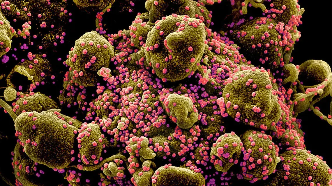 Many new vaccines are being tested to thwart the pandemic coronavirus, which infects a human cell (brown) with deadly efficiency to produce new copies (pink). National Institute of Allergy and Infectious Diseases / National Institutes of Health. Many new vaccines are being tested to thwart the pandemic coronavirus, which infects a human cell (brown) with deadly efficiency to produce new copies (pink). National Institute of Allergy and Infectious Diseases / National Institutes of Health.