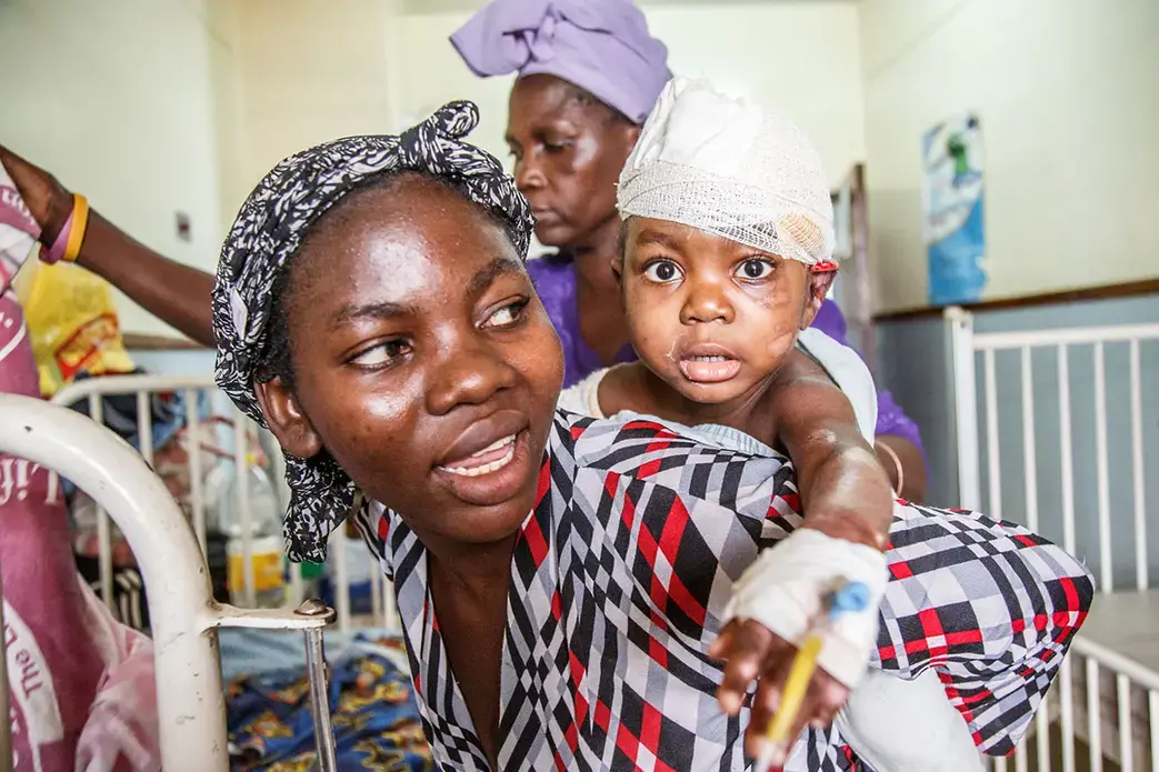 Jacqueline, 2, just comes from the operating room. She suffered severe burns and underwent second surgery at Kamuzu Central Hospital in the capital of Malawi Lilongwe. Her mother Eliza has good hope that she will be healthy again soon. Image by Nathalie Bertrams. Malawi, 2017. Jacqueline, 2., just comes from the operating room. She suffered severe burns and underwent second surgery at Kamuzu Central Hospital in the capital of Malawi Lilongwe. Her mother Eliza has good hope that she will be healthy again soon. Image by Nathalie Bertrams. Malawi, 2017.