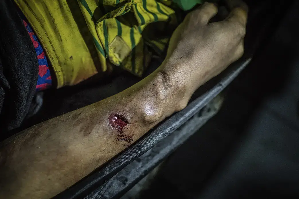 The indentation on the wrist of Julius Soriano, 24-years-old, shows signs that his hands were bound before he was shot to death during a police operation in Caloocan, Metro Manila. There is a bullet wound in his arm too, and the slug is still embedded in his arm, coming to a stop exactly were the indentation line left an impression in his skin, suggesting that whatever caused the indentation stopped the bullet too. Image by James Whitlow Delano. Philippines, 2017. The indentation on the wrist of Julius Soriano, 24-years-old, shows signs that his hands were bound before he was shot to death during a police operation in Caloocan, Metro Manila. There is a bullet wound in his arm too, and the slug is still embedded in his arm, coming to a stop exactly were the indentation line left an impression in his skin, suggesting that whatever caused the indentation stopped the bullet too. Image by James Whitlow Delano. Philippines, 2017.