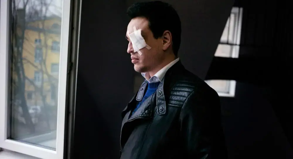 Dmitry Chizhevsky in a Saint Petersburg hospital, where he was treated for a month and a half, following an attack on an LGBT meeting. Doctors were not able to save his vision in his left eye. Image by Misha Friedman. Russia, 2013. Media file: 150321_fitzgerald_chizhevsky.jpg