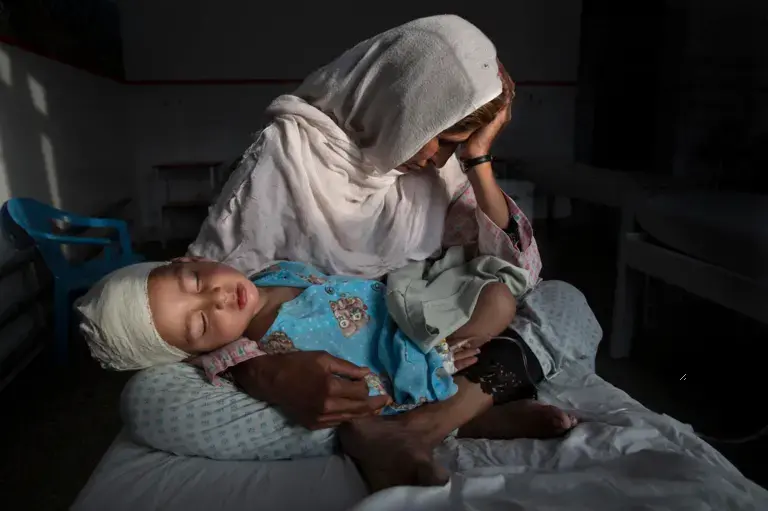 Najiba holds her nephew, Shabir, who was injured from the same bomb blast that killed his sister. Najiba watched over the children while Shabir’s mother buried her daughter. Image by Paula Bronstein. Afghanistan, 2016.