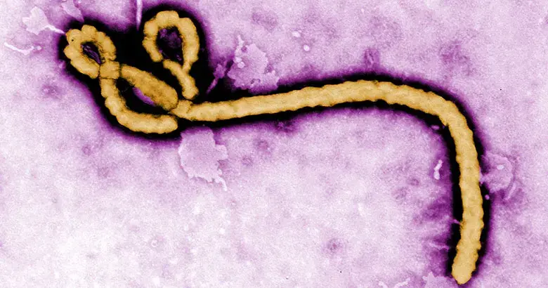 Colorized transmission electron micrograph (TEM) revealing some of the ultrastructural morphology displayed by an Ebola virus virion. Image by Frederick Murphy, Courtesy of CDC. Media file: ebola-slide-cdc-news.jpg