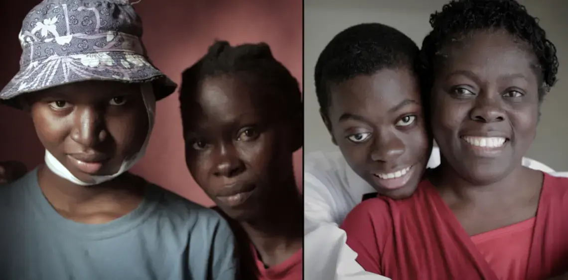 Two teenage boys in Haiti have advanced forms of cancers with high survival rates. One of them has treatment in Miami and the other is struggling to get treatment in a broken healthcare system in Haiti. Image by José A. Iglesias. Haiti, 2018. Two teenage boys in Haiti have advanced forms of cancers with high survival rates. One of them has treatment in Miami and the other is struggling to get treatment in a broken healthcare system in Haiti. Image by José A. Iglesias. Haiti, 2018.