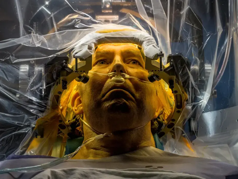 At the University of Florida, Parkinson’s disease patient Russell Price undergoes surgery to implant a deep brain stimulation (DBS) lead that will deliver electrical impulses to motion-controlling parts of his brain, treatment which has been shown to provide substantial relief from symptoms in appropriately selected patients. Additional improvement in some patients may also derive from the mere expectation that the procedure will help—the so-called placebo effect. “It’s not a magical thing,” says neurologist Michael Okun. “It’s another part of the brain that is producing a beneficial effect not directly related to the action of our treatment.” Image by Erika Larson. Florida, 2016. At the University of Florida, Parkinson’s disease patient Russell Price undergoes surgery to implant a deep brain stimulation (DBS) lead