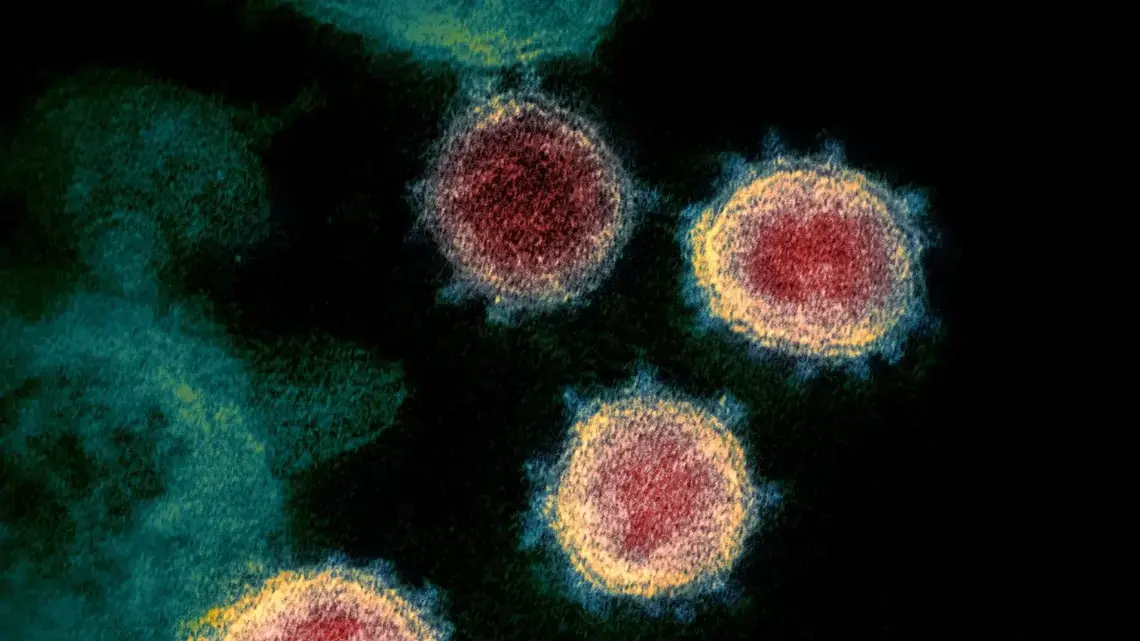 The pandemic coronavirus SARS-CoV-2 (shown above) may under certain conditions integrate its genetic material into human cells, confounding COVID-19 diagnostic tests. Image by NIAID. The pandemic coronavirus SARS-CoV-2 (shown above) may under certain conditions integrate its genetic material into human cells, confounding COVID-19 diagnostic tests. Image by NIAID.