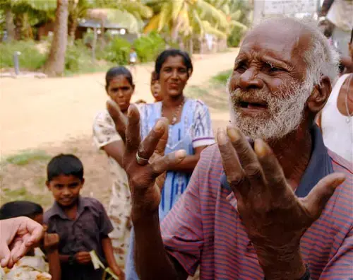 This elderly man was forced from his home two years ago and is desperate to return, Eastern Province. 1