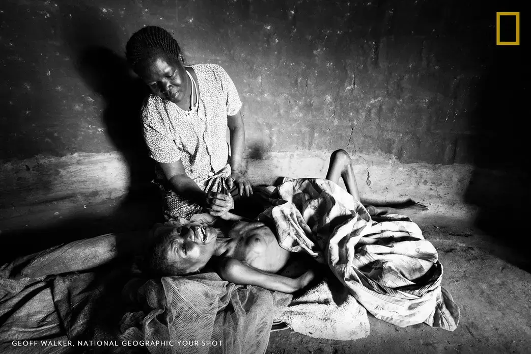 Lanyero Christine languishes over her 18-year-old daughter and Nodding disease sufferer in Awere, Pader District, Uganda. Monica is close to death yet her mother still keeps the family of six children together; her son died of the disease in 2014. Image by Geoff Walker. Uganda.