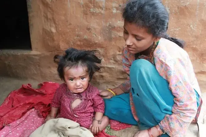 Suntali Thami is among the 51 percent of Nepalese who marry as children, according to the United Nation’s Children’s Fund (UNICEF). Image by Hanna Ingber. Nepal, 2011. Media file: Nepal.jpg