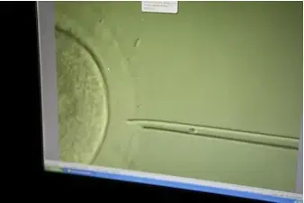 A computer screen showing the moment of conception at a the Institut Marquès in Barcelona.