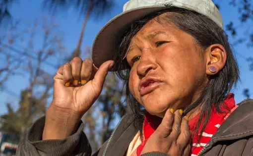 Esmeralda Cespedes, 25, said she doesn't inhale glue. But she drinks alcohol “because of the problems I have in my life. A lot of people bother me.” Image by Tracey Eaton. Bolivia, 2017.