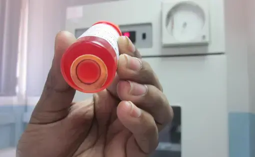 Corneas must be used within about four weeks.