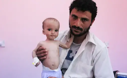 Burhan Nasser holds his nine-month old son, Shaker, at the only therapeutic feeding centre for children suffering from severe acute malnutrition in Yemen's city of Aden. Image by Iona Craig. Yemen, 2017.