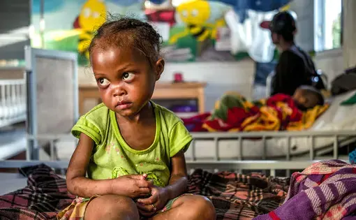 After being treated for severe malnutrition at Ifanadiana District Hospital, this girl is about to go home. Image by Rijasolo. Madagascar, 2019.