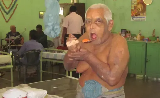 A patient and the hospital band at the Hendala Leprosy Hospital, Sri Lanka.