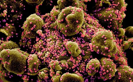 Many new vaccines are being tested to thwart the pandemic coronavirus, which infects a human cell (brown) with deadly efficiency to produce new copies (pink). National Institute of Allergy and Infectious Diseases / National Institutes of Health.
